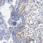 Immunohistochemical staining of human placenta shows high expression.
