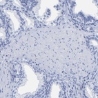 Immunohistochemical staining of human prostate shows low expression as expected.