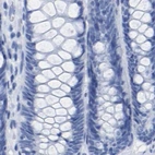 Immunohistochemical staining of human colon using Anti-HAPLN1 antibody HPA019105.