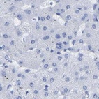 Immunohistochemical staining of human liver using Anti-HAPLN1 antibody HPA019105.
