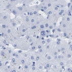 Immunohistochemical staining of human liver using Anti-HAPLN1 antibody HPA019105.