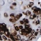 Immunohistochemical staining of human bronchus using Anti-HAPLN1 antibody HPA019105.