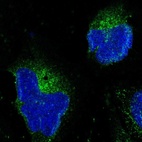 Immunofluorescent staining of human cell line U-2 OS shows localization to vesicles.