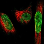 Immunofluorescent staining of human cell line U-251 MG shows localization to nucleoplasm & nuclear membrane.