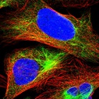 Immunofluorescent staining of human cell line U-2 OS shows localization to intermediate filaments.