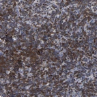Anti-PTPN7 Antibody