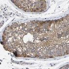 Immunohistochemical staining of human testis shows strong cytoplasmic positivity in cells in seminiferous ducts.