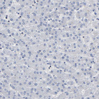 Anti-PTPN7 Antibody