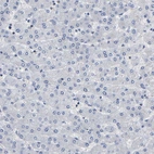 Immunohistochemical staining of human liver shows no positivity in hepatocytes as expected.