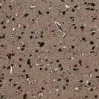 Immunohistochemical staining of human cerebral cortex shows very strong cytoplasmic positivity in neurons.
