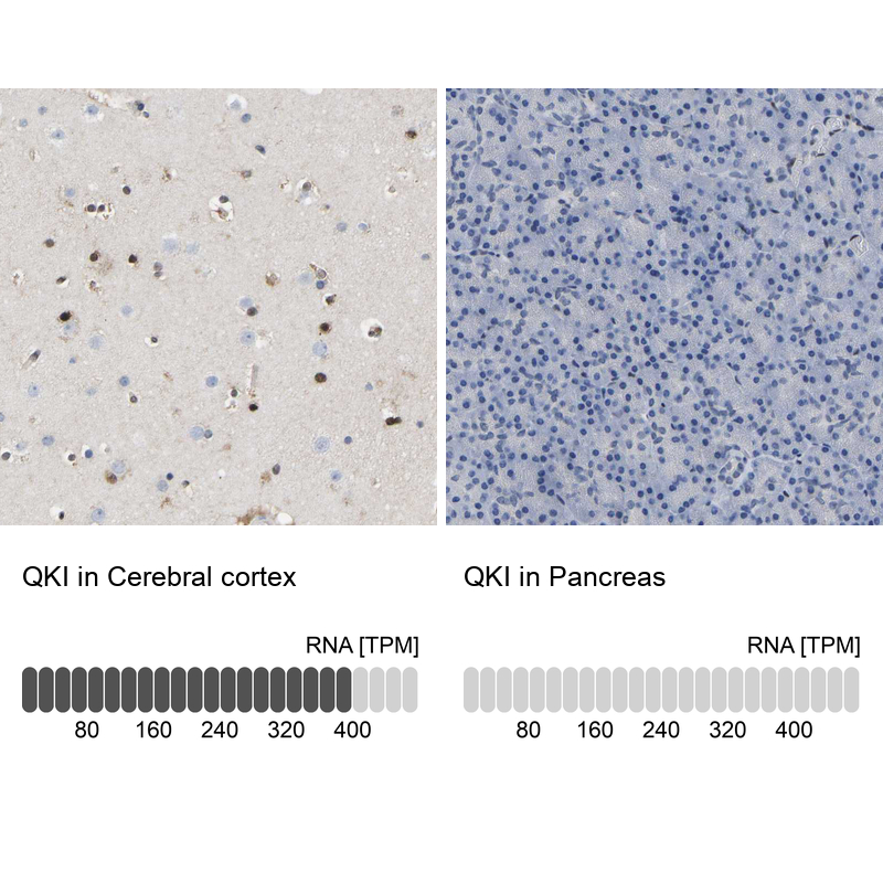 Anti-QKI Antibody