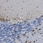 Immunohistochemical staining of human cerebellum shows moderate to strong nuclear positivity in glial cells.