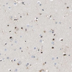 Immunohistochemical staining of human cerebral cortex shows moderate to strong nuclear positivity in glial cells.