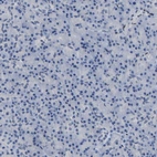 Immunohistochemical staining of human pancreas shows no positivity in exocrine glandular cells as expected.