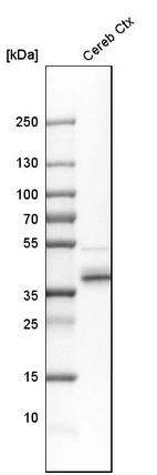 Western blot analysis in human cerebral cortex tissue.