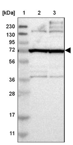 Lane 1: Marker [kDa] 230, 130, 95, 72, 56, 36, 28, 17, 11_br/_Lane 2: Human cell line RT-4_br/_Lane 3: Human cell line U-251MG sp