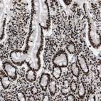 Anti-SMARCB1 Antibody