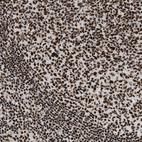 Immunohistochemical staining of human lymph node shows strong nuclear positivity in germinal and non germinal center cells.