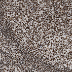 Anti-SMARCB1 Antibody