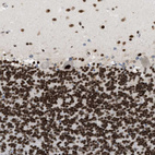 Anti-SMARCB1 Antibody