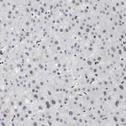 Anti-SMARCB1 Antibody