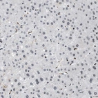 Immunohistochemical staining of human liver shows very weak positivity in hepatocytes as expected.