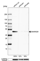 Western blot analysis in HEK293 cells transfected with control siRNA, target specific siRNA probe #1 and #2, using Anti-SMARCB1 antibody. Remaining relative intensity is presented. Loading control: Anti-GAPDH.