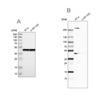 Western blot analysis using Anti-SMARCB1 antibody HPA019127 (A) shows similar pattern to independent antibody HPA018248 (B).