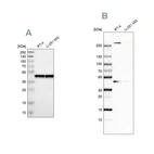 Western blot analysis using Anti-SMARCB1 antibody HPA019127 (A) shows similar pattern to independent antibody HPA018248 (B).