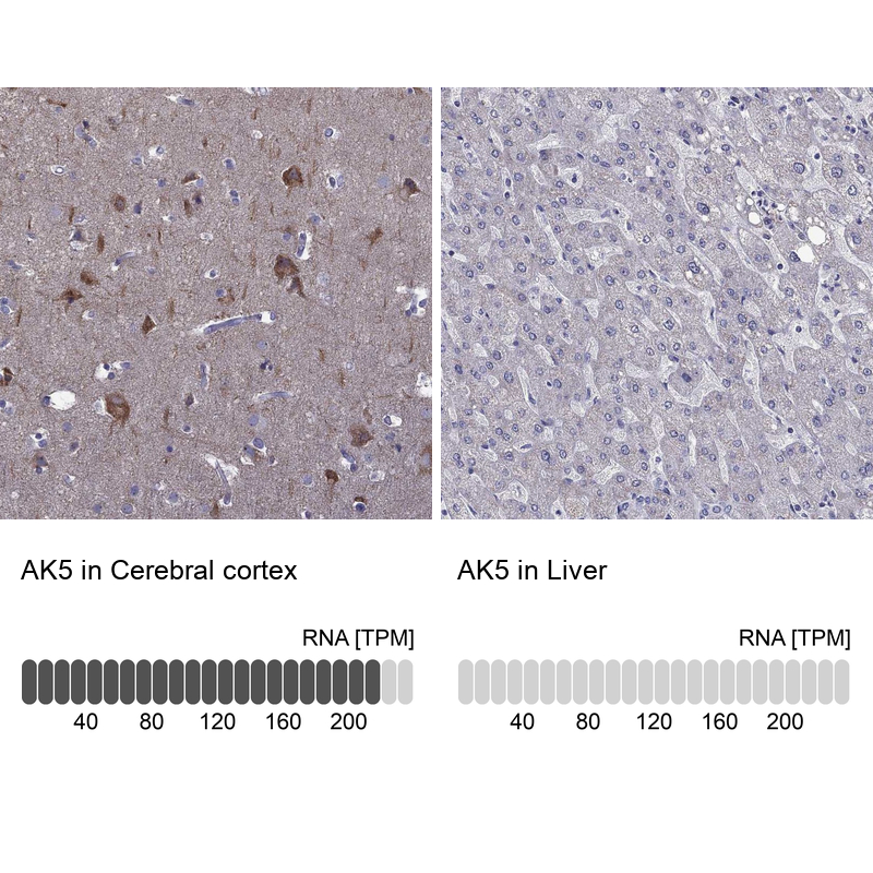 Anti-AK5 Antibody