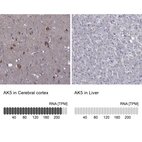Anti-AK5 Antibody