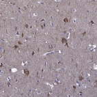 Immunohistochemical staining of human cerebral cortex shows high expression.