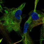Immunofluorescent staining of human cell line LHCN-M2 shows localization to cytosol.