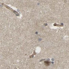 Immunohistochemical staining of human cerebral cortex using Anti-SERPINB5 antibody HPA019132.