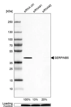 Western blot analysis in HeLa cells transfected with control siRNA, target specific siRNA probe #1 and #2, using Anti-SERPINB5 antibody. Remaining relative intensity is presented. Loading control: Anti-PPIB.