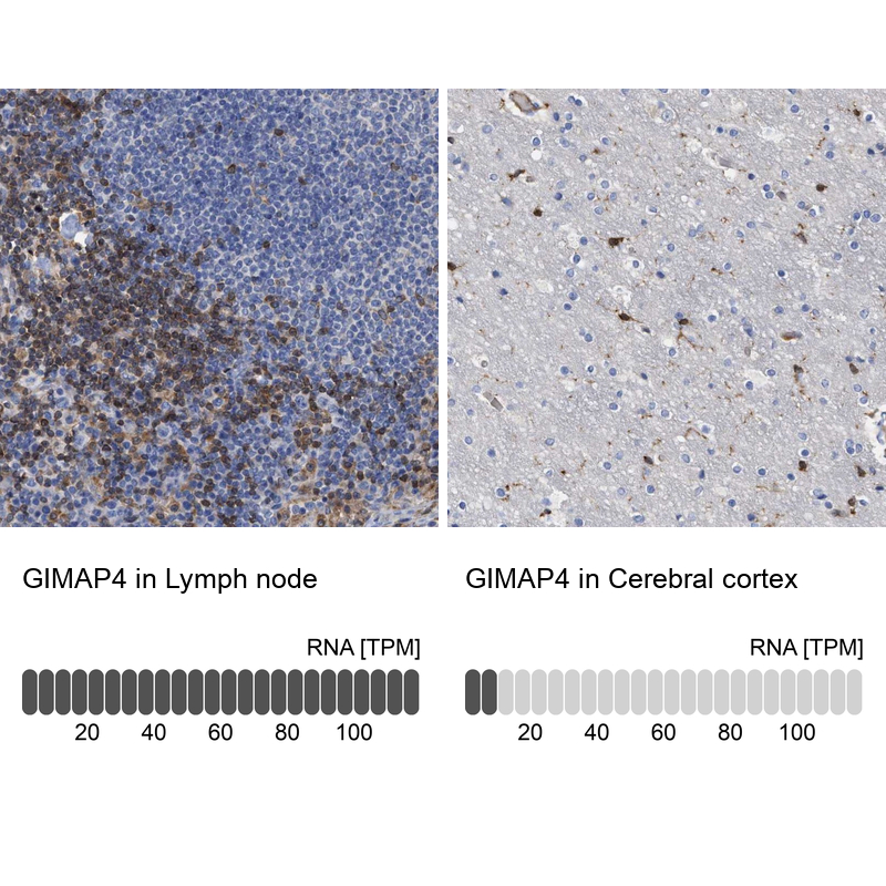 Anti-GIMAP4 Antibody