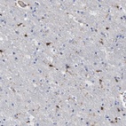 Immunohistochemical staining of human cerebral cortex shows low expression as expected.