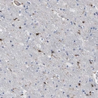Immunohistochemical staining of human cerebral cortex shows low expression as expected.