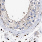 Immunohistochemical staining of human testis using Anti-GIMAP4 antibody HPA019135.