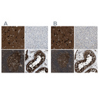 Anti-NUDCD3 Antibody