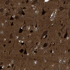 Immunohistochemical staining of human cerebral cortex shows strong cytoplasmic positivity in neurons.