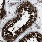 Immunohistochemical staining of human testis shows strong cytoplasmic positivity in cells in seminiferous ducts.