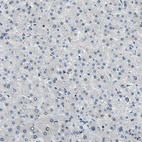 Anti-NUDCD3 Antibody