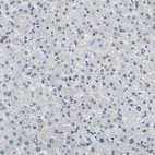 Immunohistochemical staining of human liver shows no positivity in hepatocytes as expected.