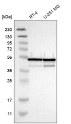 Western blot analysis in human cell line RT-4 and human cell line U-251 MG.
