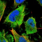 Immunofluorescent staining of human cell line U-251 MG shows localization to plasma membrane & cytosol.