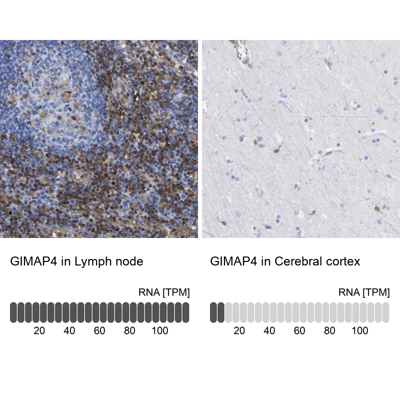 Anti-GIMAP4 Antibody