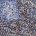 Immunohistochemical staining of human lymph node shows high expression.