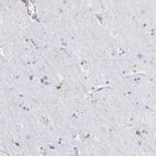 Immunohistochemical staining of human cerebral cortex shows low expression as expected.