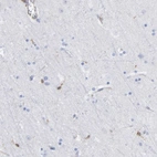 Immunohistochemical staining of human cerebral cortex shows low expression as expected.